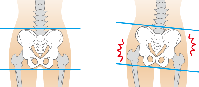 生理痛を改善するには骨盤の歪みを整えることが大切です。