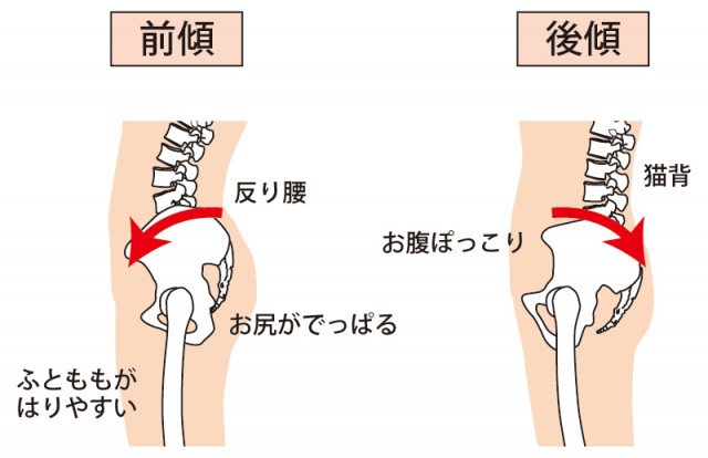 当院の子宮筋腫への対処法とは?